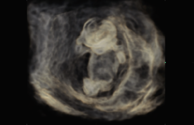 HS40_crystal_vue