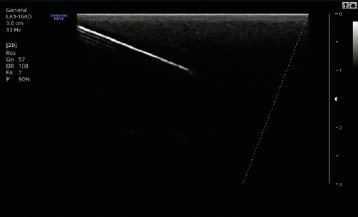 samsung_hs40_needle_mate