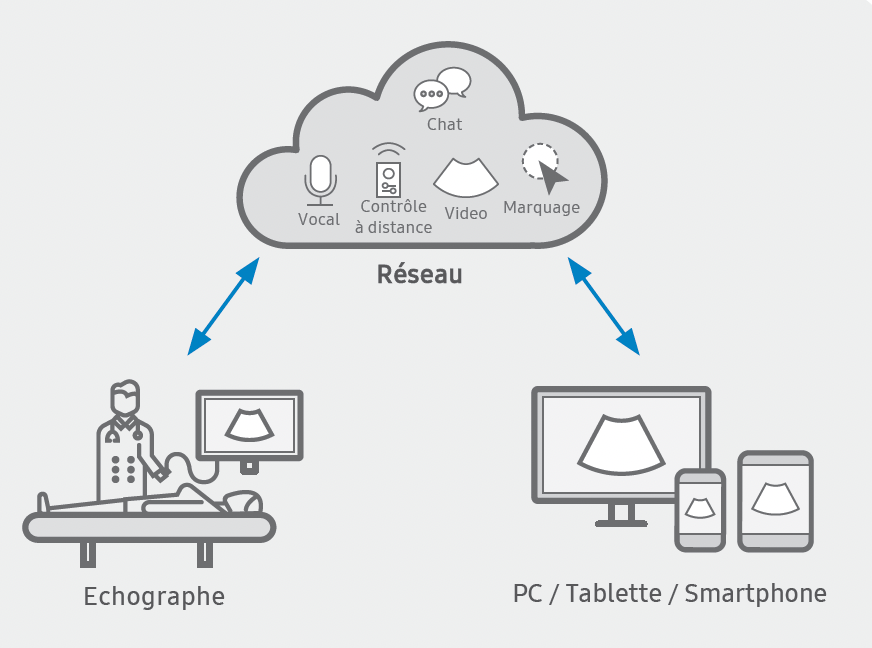 echographe_samsung_v5_sonosync
