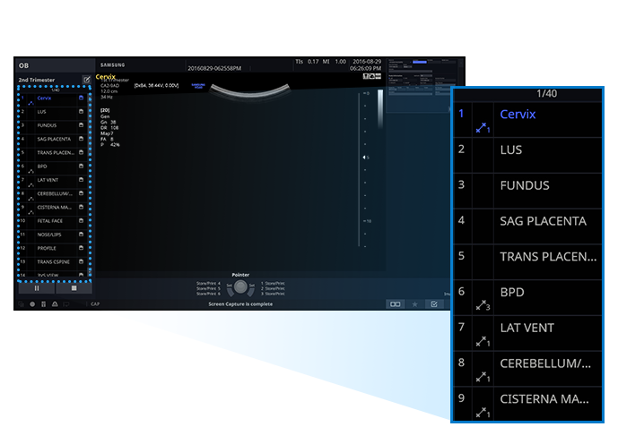 EzExam+_echographie