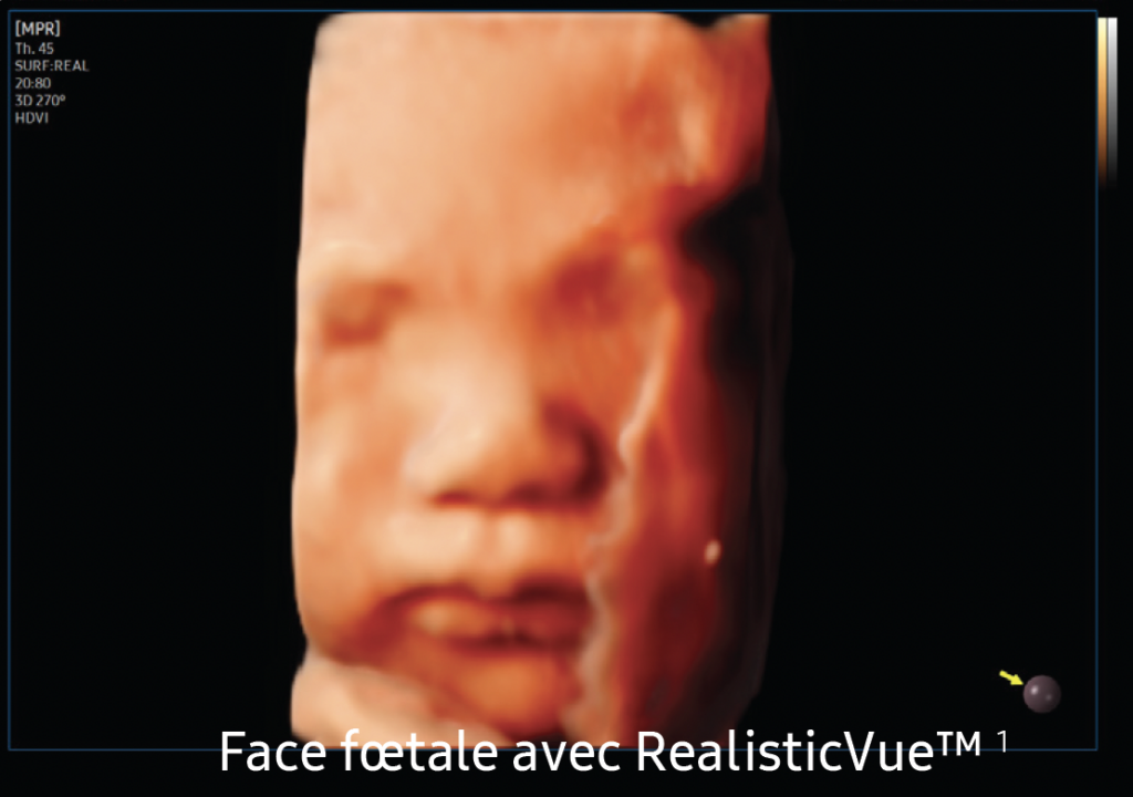 V6_realistic_vue