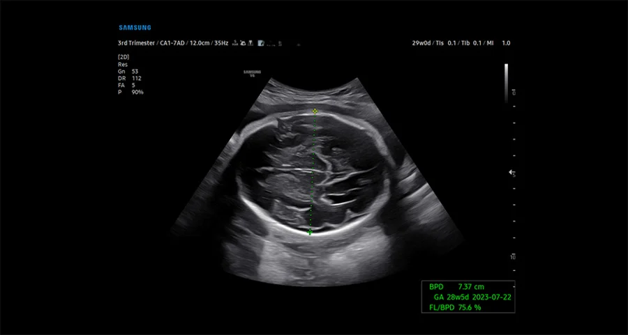 usa-samsung-wh-v6-biometry-assist