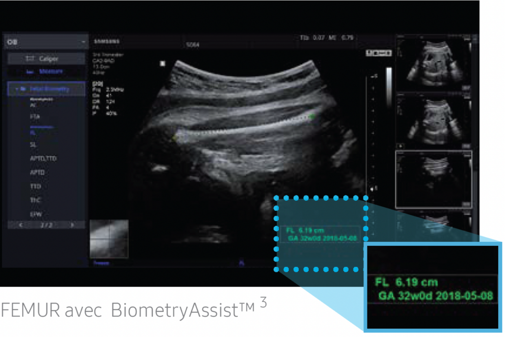 samsung_HS50_biometry_assist