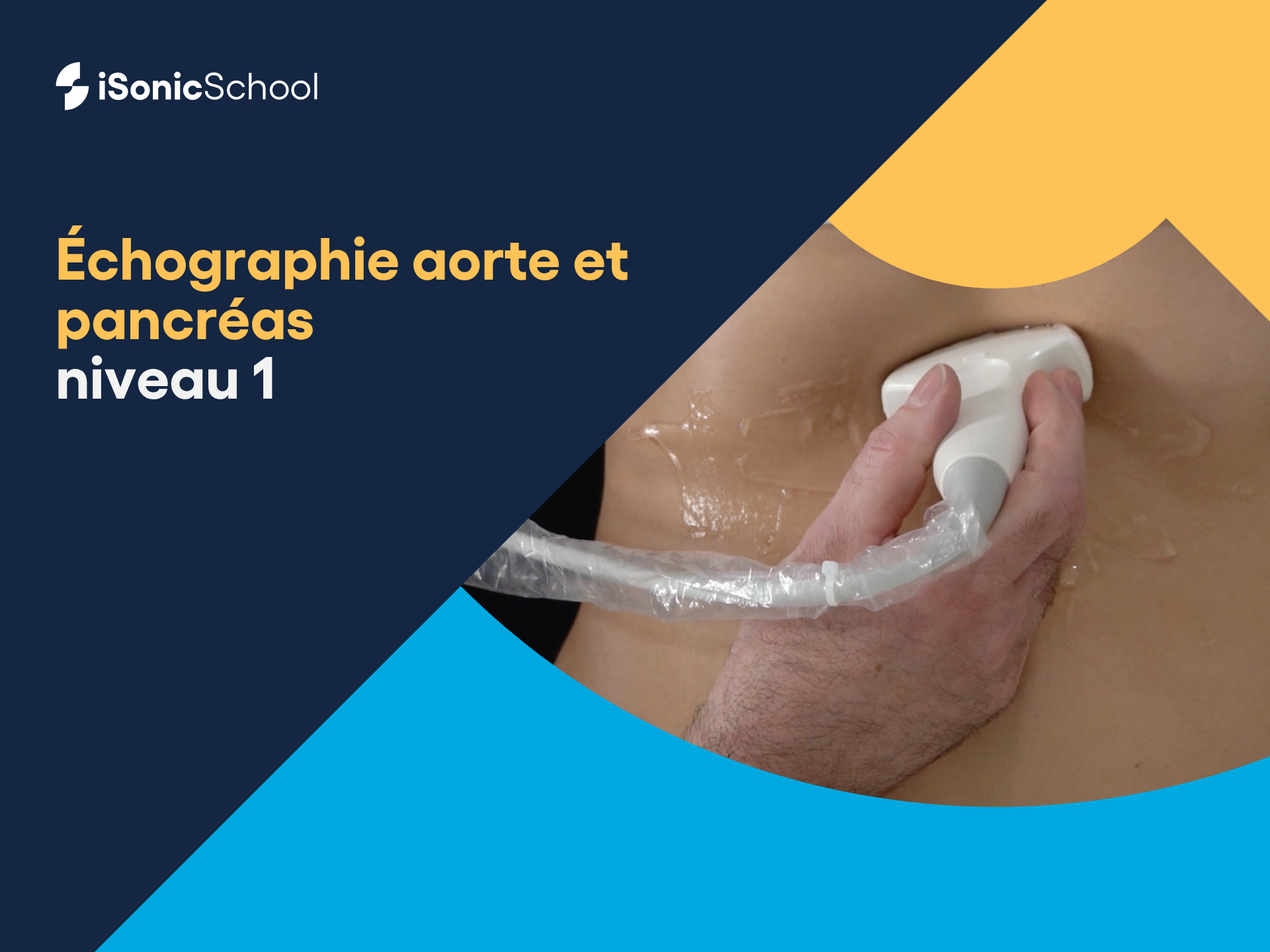 Échographie de l'aorte et du pancréas