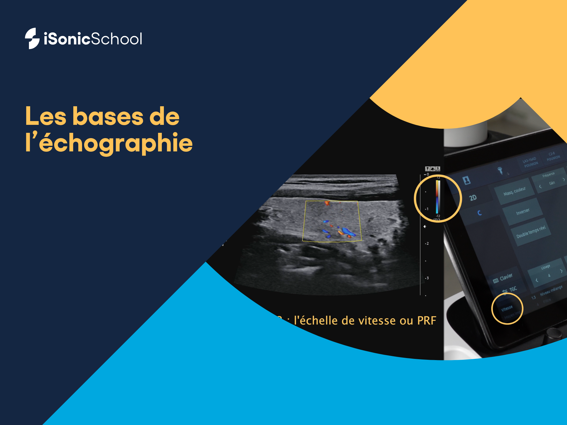 Les bases de l'échographie