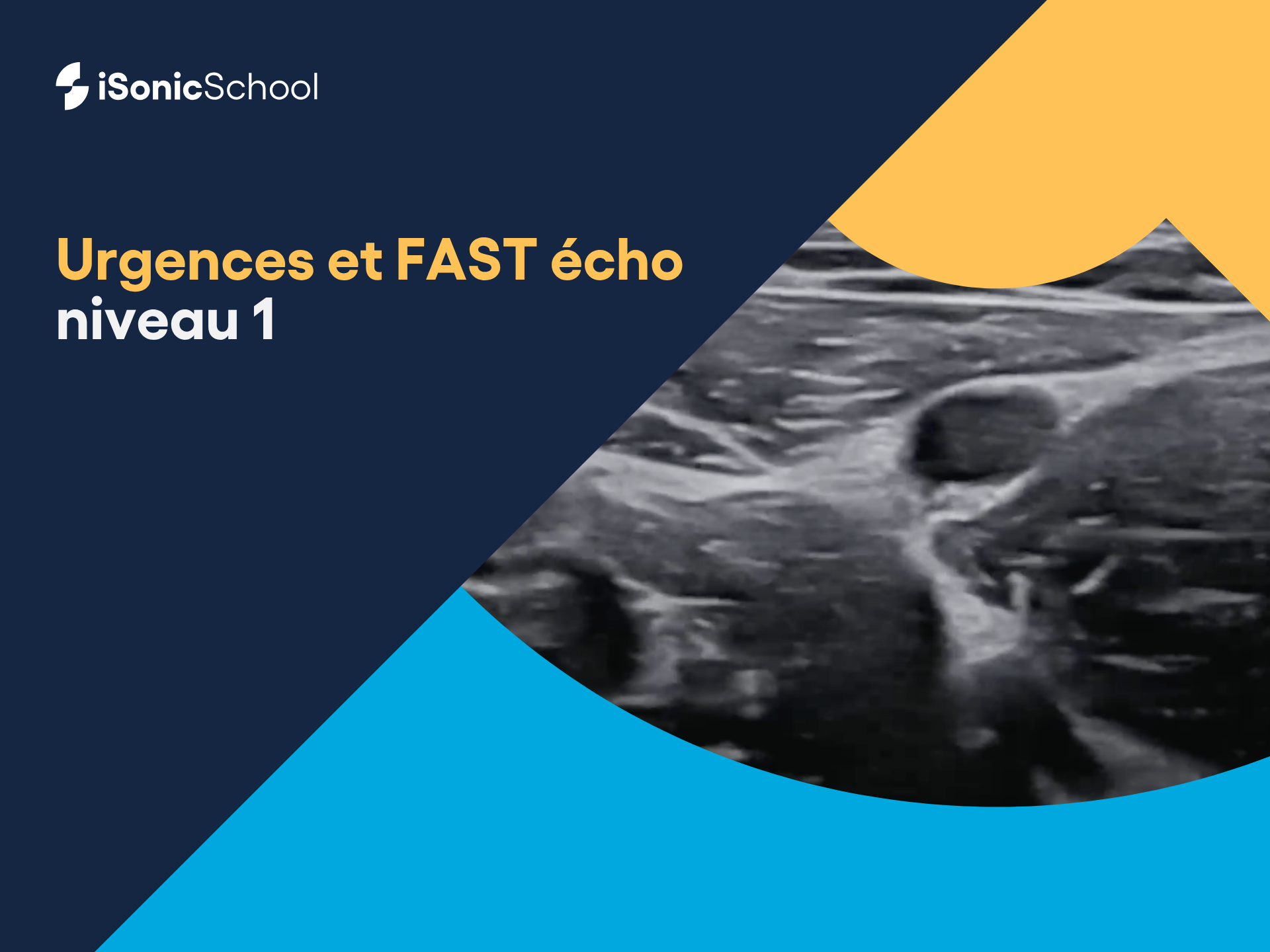 Urgences et FAST