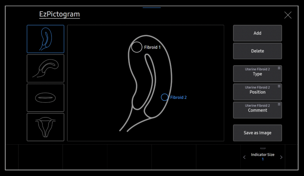 evo_Q10_EZ_pictogram