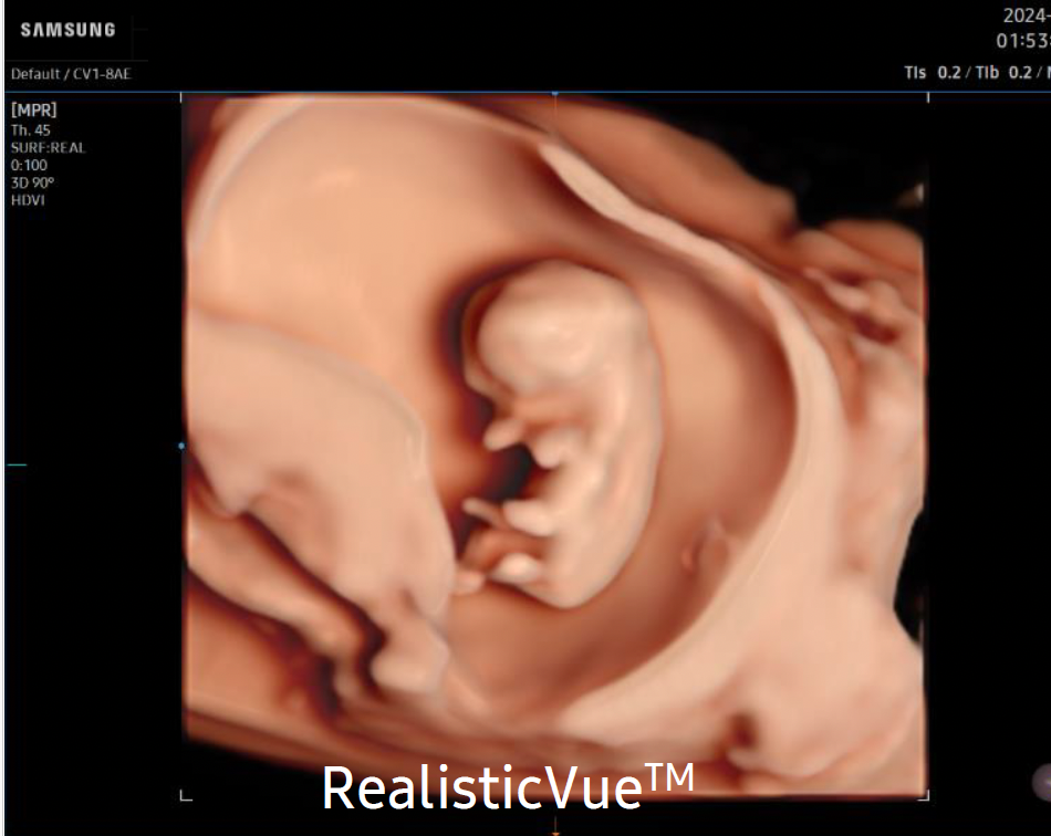 evo_Q10_realistic_vue