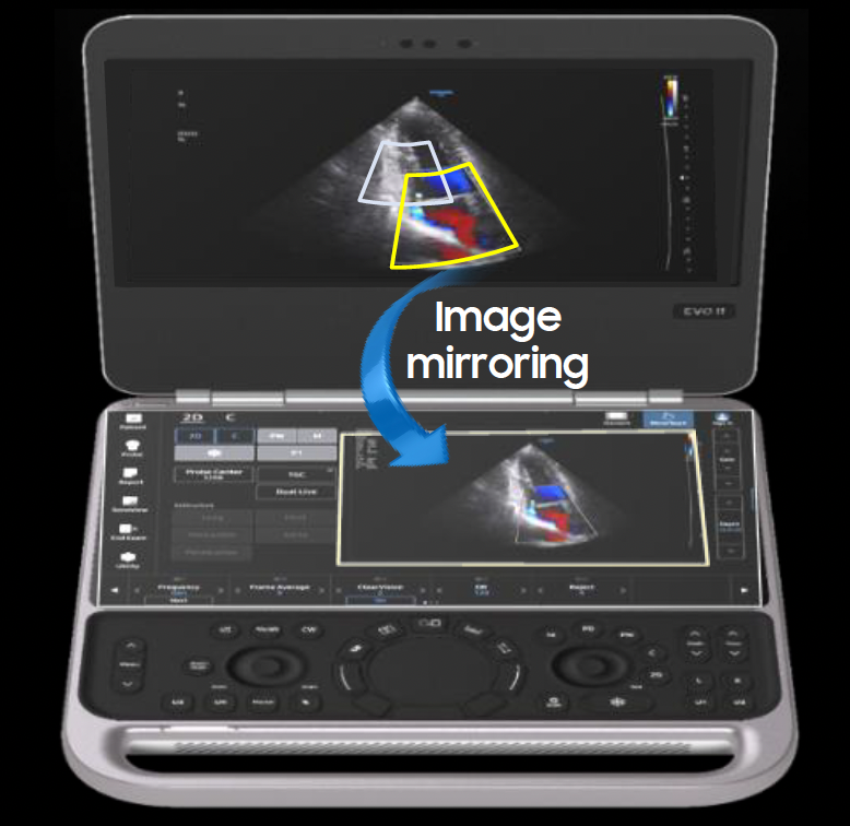 evo_q10_mirror_touch