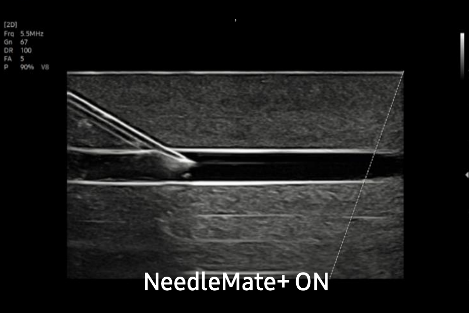 samsung_evo_q10_needle_mate
