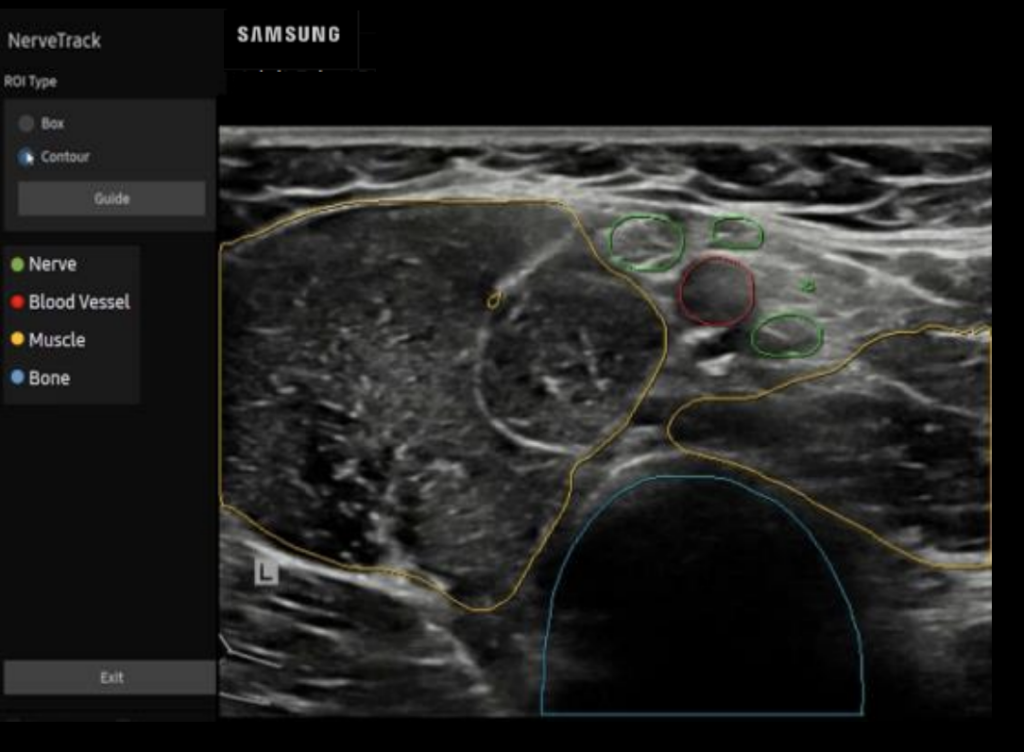 samsung_evo_q10_nerve_track