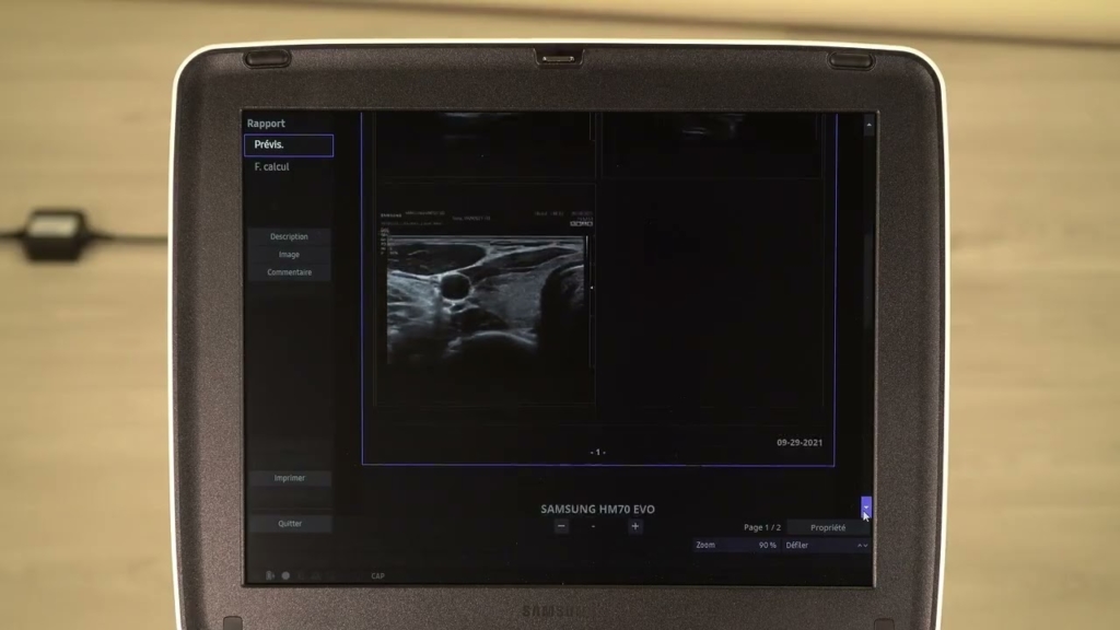 Miniature du tuto Samsung HM70 EVO tuto 11 Création d'un rapport d'examen