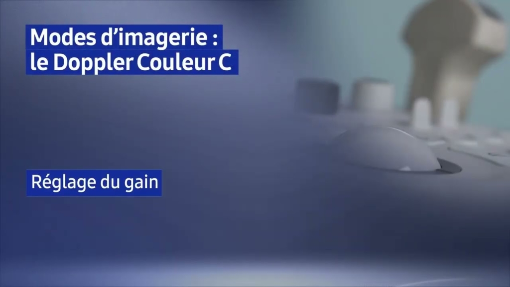 Miniature du tuto Samsung HS30 tuto 04 Doppler Couleur C