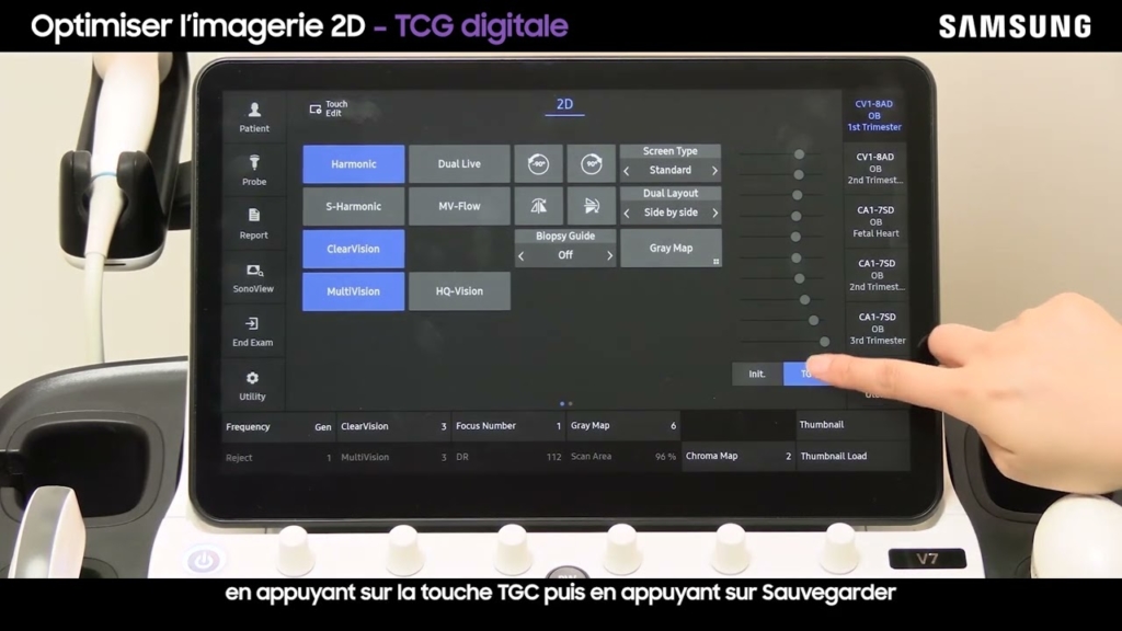 Miniature du tuto Samsung V7 tuto 02 Optimiser l'imagerie 2D en obstétrique