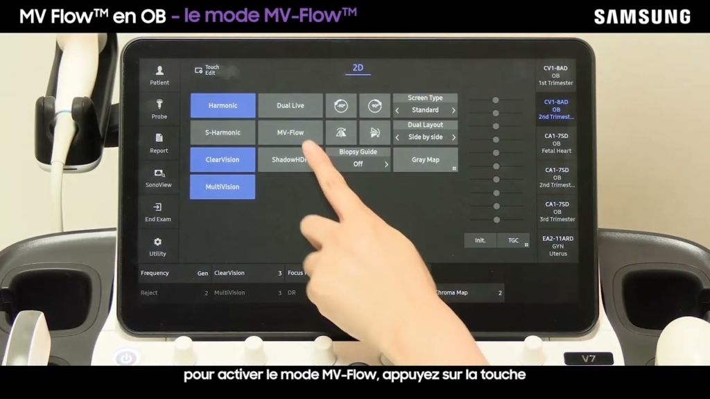 Miniature du tuto Samsung V7 tuto 06 Microvascularisation en obstétrique avec MV Flow