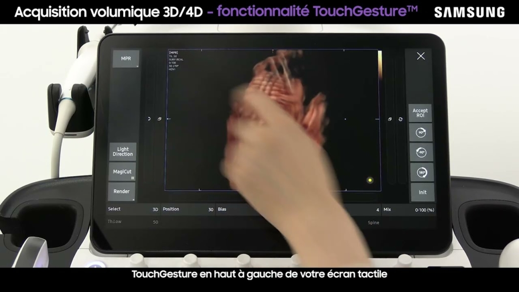 Miniature du tuto Samsung V7 tuto 07 Faire une acquisition volumique 3D-4D