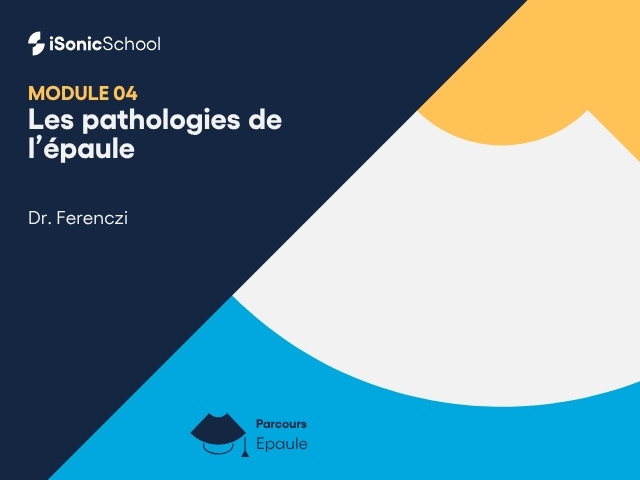 Miniature — MSK épaule — Pathologies