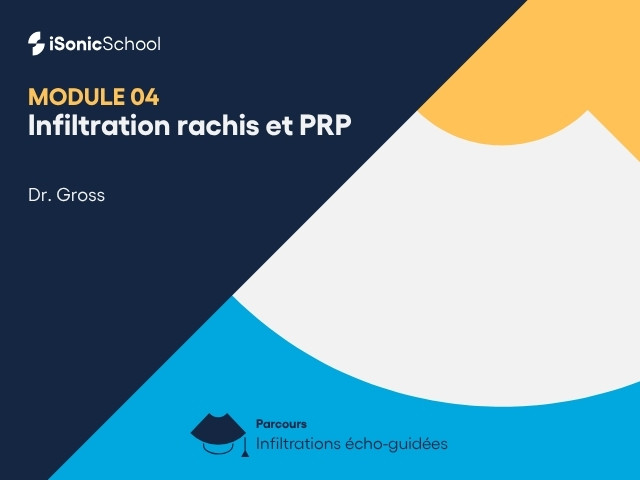 Miniature — Infiltrations écho-guidées — Rachis et PRP