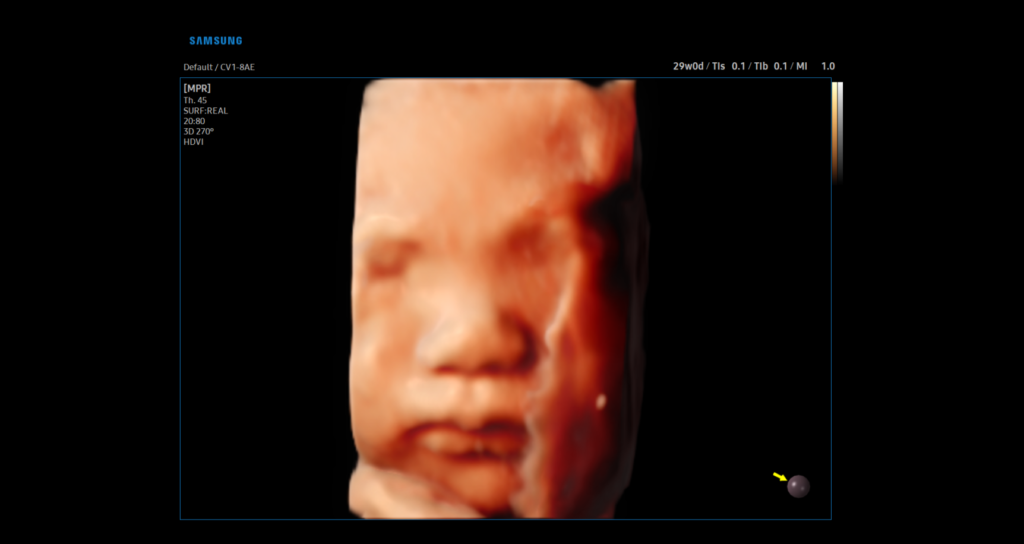 v6_sf_visualisation-3d-de-l-anatomie-avec-un-rendu-realiste-et-detaille