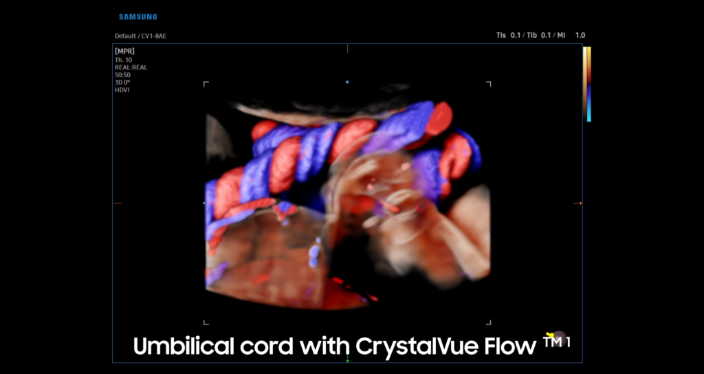 CrystalVue™ — Visualisation des structures internes et externes ainsi que de la morphologie du