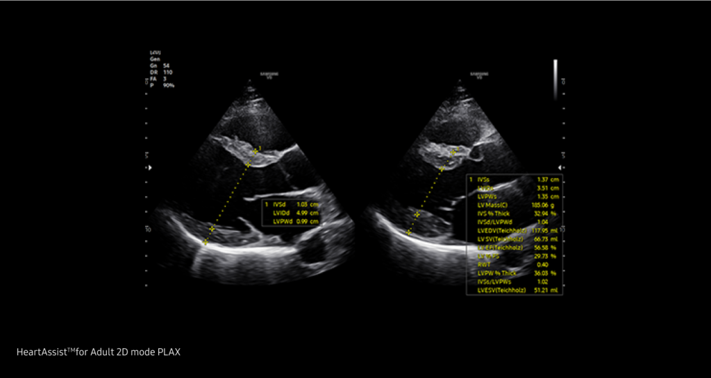 5D Heart Color™ / S-Fusion™ / HeartAssist™ — Un outil de rapport automatisé pour le diagnostic cardiaque