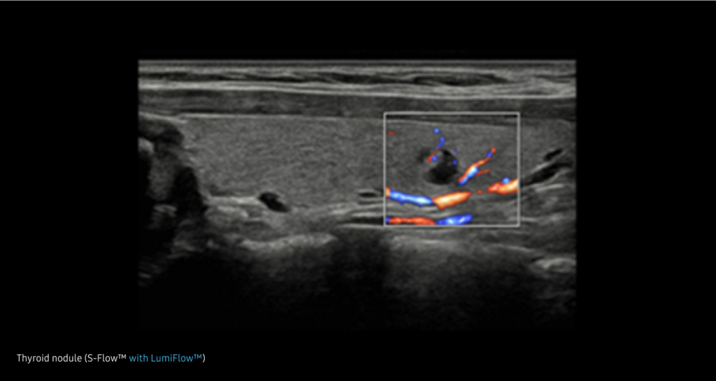 LumiFlow™ — Visualisation tridimensionnelle du flux sanguin