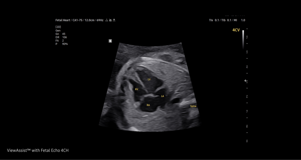 ViewAssist™ / EzExam™ — Une classification et des annotations automatisees des images