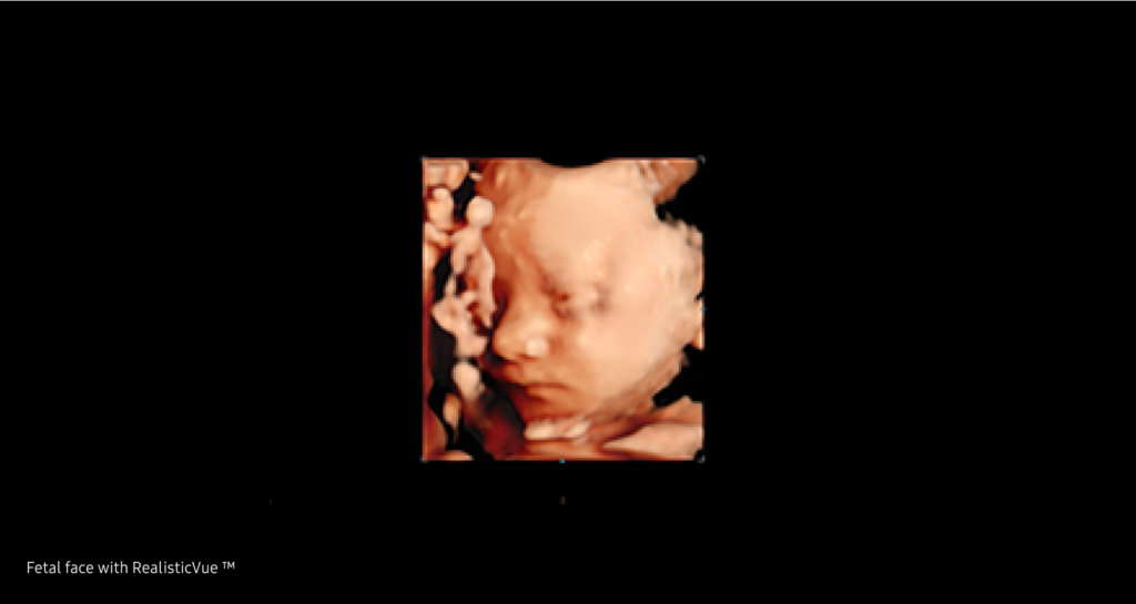 CrystalLive™ / RealisticVue™ / PortraitVue™ — Visualisation 3d de l anatomie avec un rendu realiste et detaille
