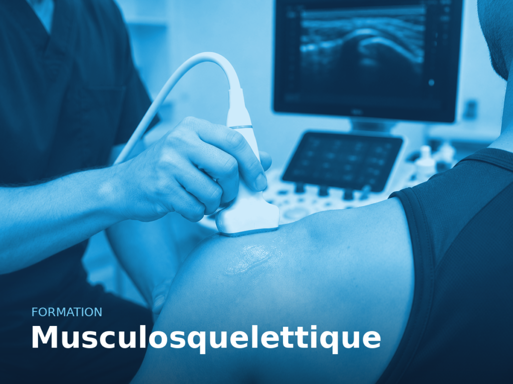 vignette-musculosquelettique