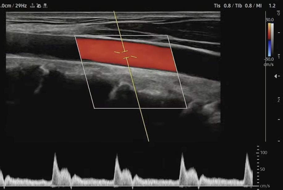 quickscan_optimisation_automatique_echographe_samsung