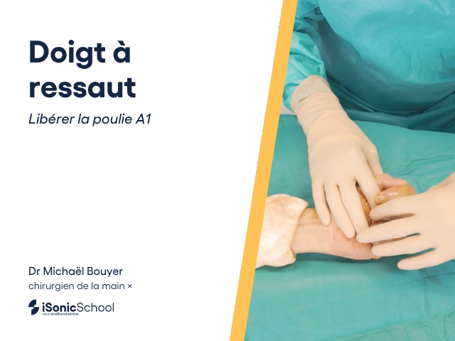 Module 4 · Doigt à ressaut