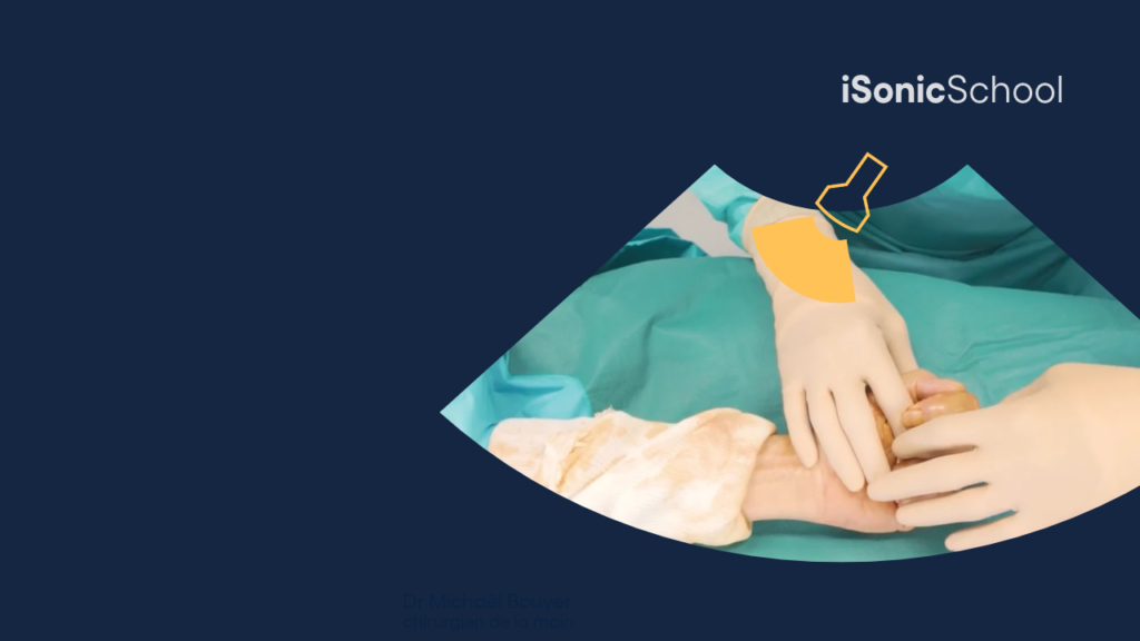 Teaser Parcours Èchochirurgie (2)
