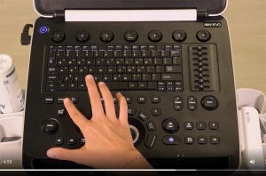 tuto vidéo échographie samsung HM70 EVO