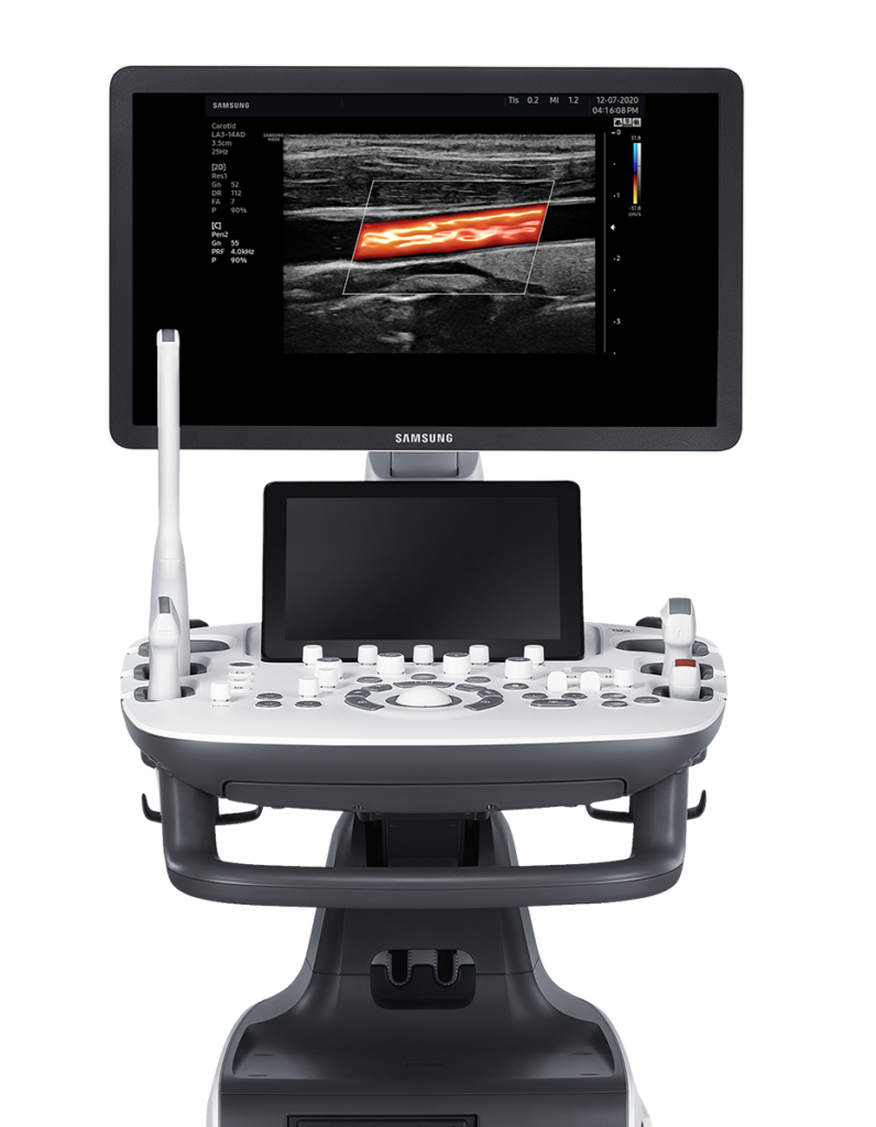 Echographe Samsung HS50 vue de face