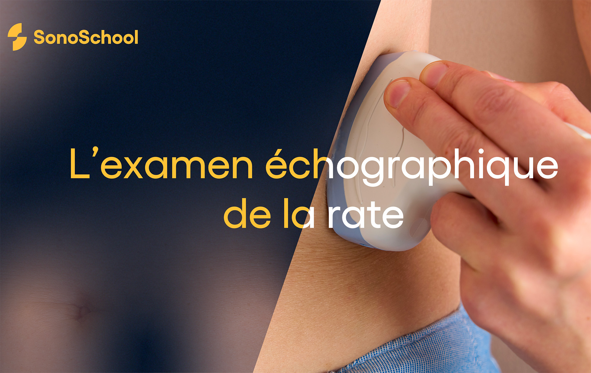 chographie Des Reins De La Vessie chographie De La Rate chographie-des-reins-de-la-vessie-chographie-de-la-rate